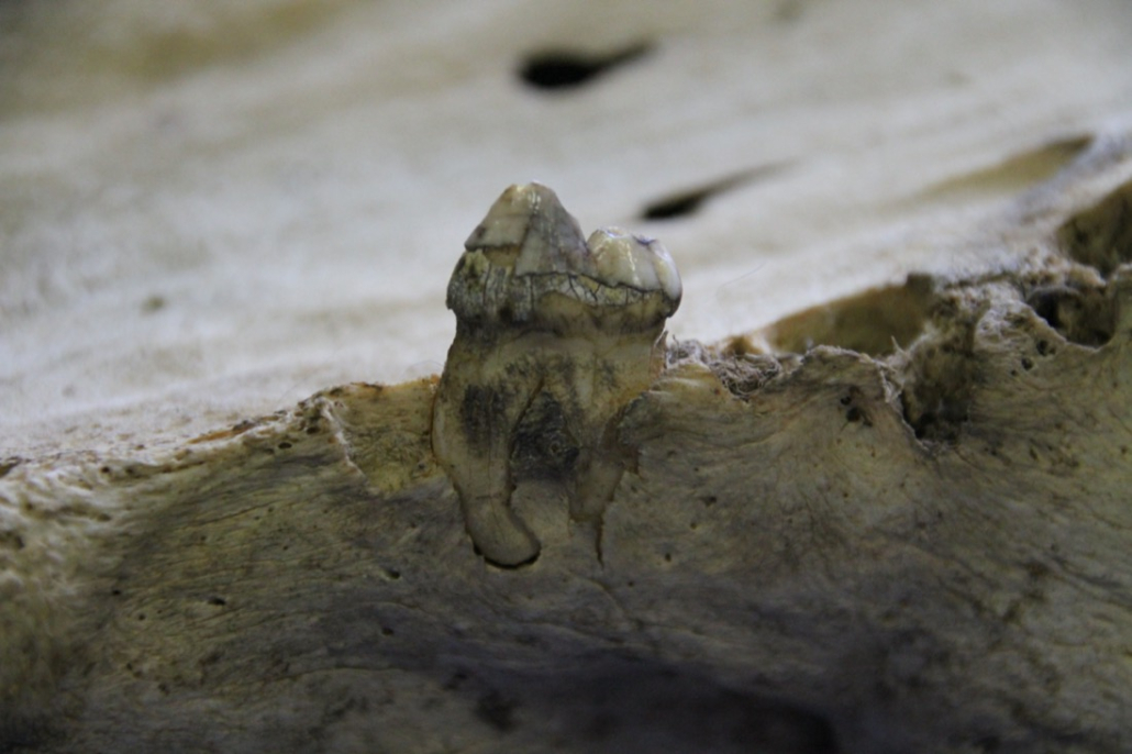 Museum tooth sampling